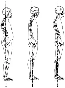 back posture